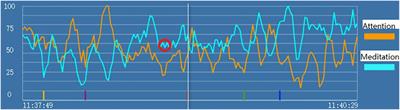 Research on the Method of Depression Detection by Single-Channel Electroencephalography Sensor